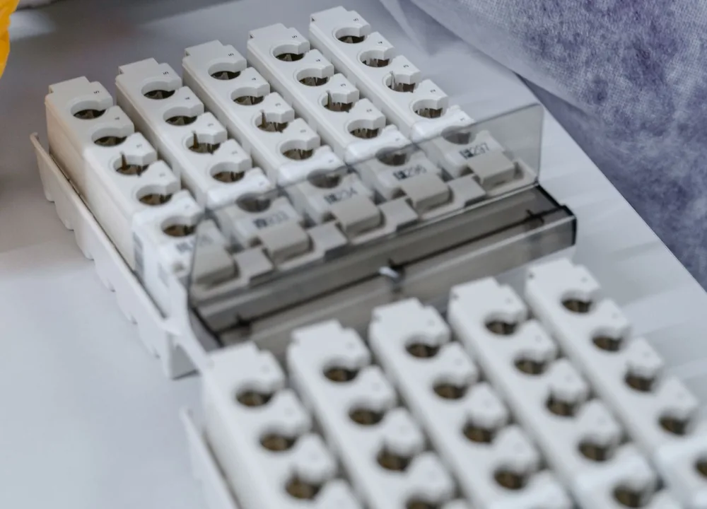 Testis Kanserinde Tedavi Sonrası Takip: Tümör Belirteçleri (AFP, Beta-hCG, LDH) Ne Anlatır?